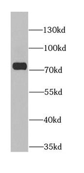 ANTXR2 Rabbit Polyclonal Antibody