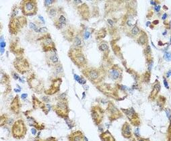 ANTXR2 Rabbit Polyclonal Antibody