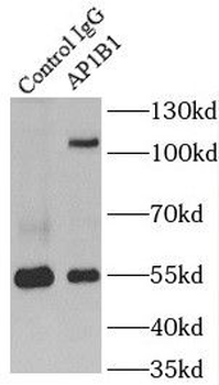 AP1B1 Antibody
