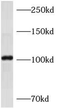 AP1B1 Antibody