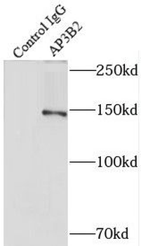 AP3B2 Rabbit Polyclonal Antibody