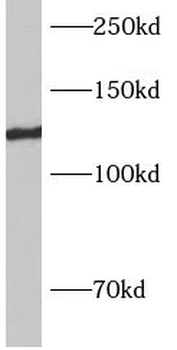 AP3B2 Rabbit Polyclonal Antibody