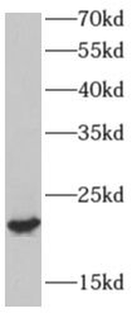 AP3S2 Rabbit Polyclonal Antibody