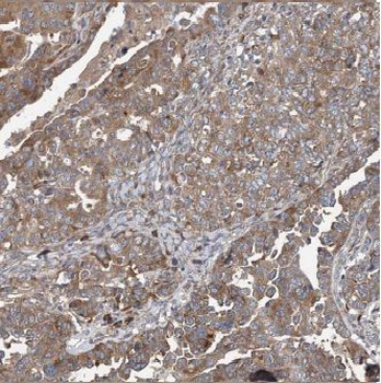 AP3S2 Rabbit Polyclonal Antibody