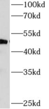 AP4M1 Rabbit Polyclonal Antibody