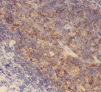 AP4M1 Rabbit Polyclonal Antibody
