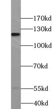 APBA2 Rabbit Polyclonal Antibody