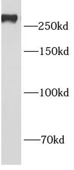 APC Rabbit Polyclonal Antibody