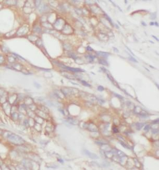 APC Rabbit Polyclonal Antibody