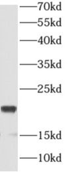 ANAPC11 Rabbit Polyclonal Antibody