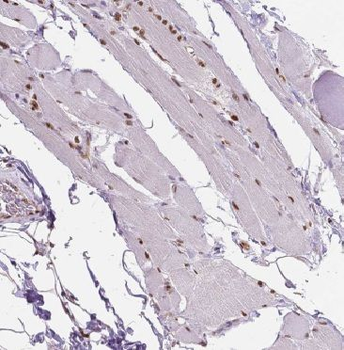 ANAPC11 Rabbit Polyclonal Antibody