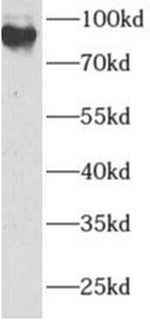 ANAPC2 Rabbit Polyclonal Antibody