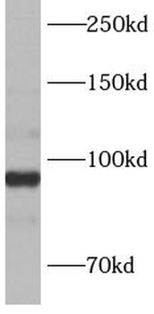 ANAPC4 Rabbit Polyclonal Antibody