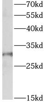APH1A Rabbit Polyclonal Antibody
