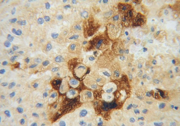 APOH Rabbit Polyclonal Antibody