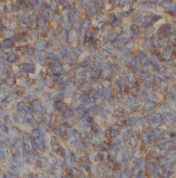 APOH Mouse Monoclonal Antibody