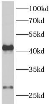 AQP1 Antibody