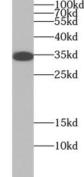 AQP4 Antibody
