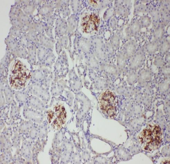 AQP4 Antibody
