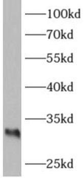 ARAF Rabbit Polyclonal Antibody