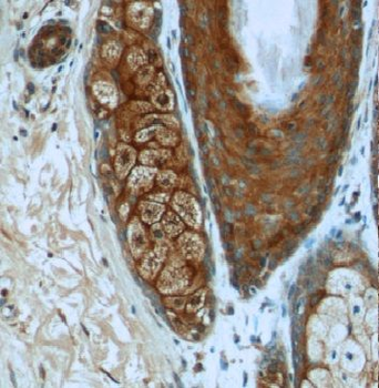 ARAF Rabbit Polyclonal Antibody