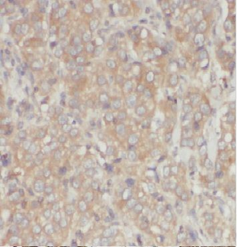 ARD1A Rabbit Polyclonal Antibody