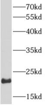 ARF1 Rabbit Polyclonal Antibody