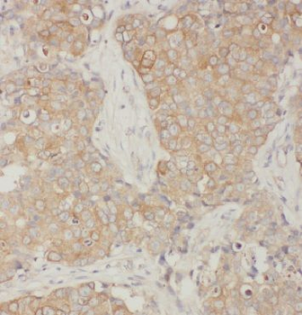 ARF1 Rabbit Polyclonal Antibody