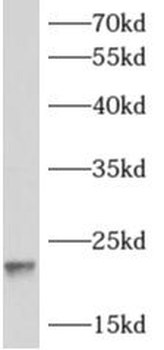 ARF1 Rabbit Polyclonal Antibody