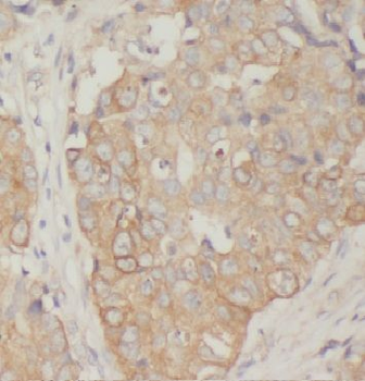 ARF1 Rabbit Polyclonal Antibody
