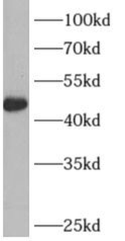 ARFGAP1 Rabbit Polyclonal Antibody