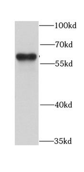 ARFGAP3 Rabbit Polyclonal Antibody