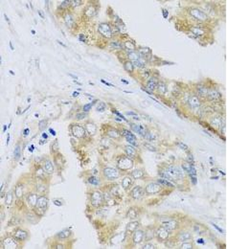 ARFGAP3 Rabbit Polyclonal Antibody