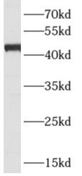 ARFIP1 Rabbit Polyclonal Antibody