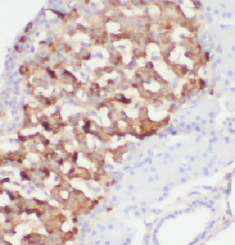 ARFIP1 Rabbit Polyclonal Antibody