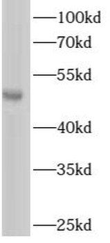 ARHGAP1 Rabbit Polyclonal Antibody