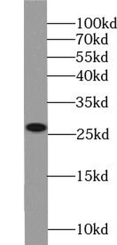 ARHGDIB Rabbit Polyclonal Antibody