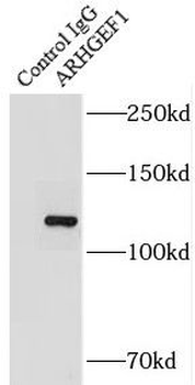 ARHGEF1 Rabbit Polyclonal Antibody