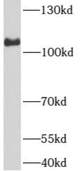 ARHGEF1 Rabbit Polyclonal Antibody