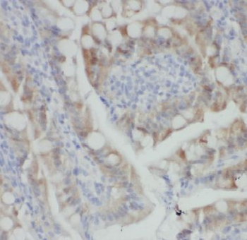 ARHGEF1 Rabbit Polyclonal Antibody