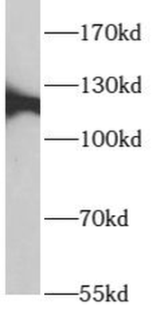 ARHGEF18 Rabbit Polyclonal Antibody
