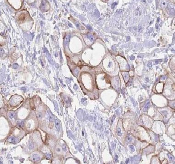 ARHGEF18 Rabbit Polyclonal Antibody