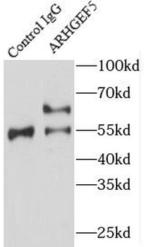 ARHGEF5 Antibody