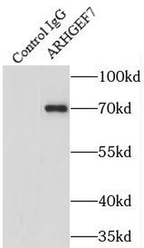ARHGEF7 Antibody