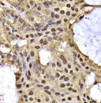 ARID3A Rabbit Polyclonal Antibody