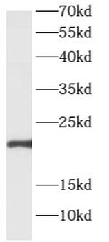 ARL2BP Antibody