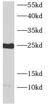 ARL4C Rabbit Polyclonal Antibody