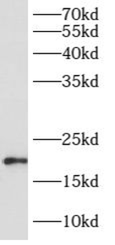 ARL8A Rabbit Polyclonal Antibody