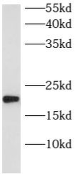 ARL8B Rabbit Polyclonal Antibody