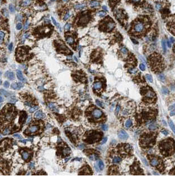 ARL8B Rabbit Polyclonal Antibody